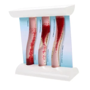 Model Showing Health to Illness Evolution Lightweight Design for Students and Teachers Cabilock Blood Vessel enactment torpor Model Anatomical Teaching Tool for Medical Studies High Simulation Vascular 